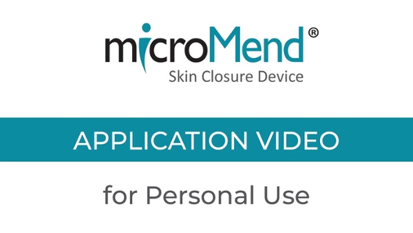 Micromend Skin Closure: Revolutionizing Wound Care Solutions